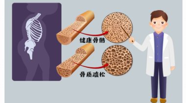 補腎抗衰系列談——腰腿衰老并不是老年人的專利