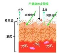 vinistyle教你掌控敏感肌，不做嬌氣“瓷娃娃”